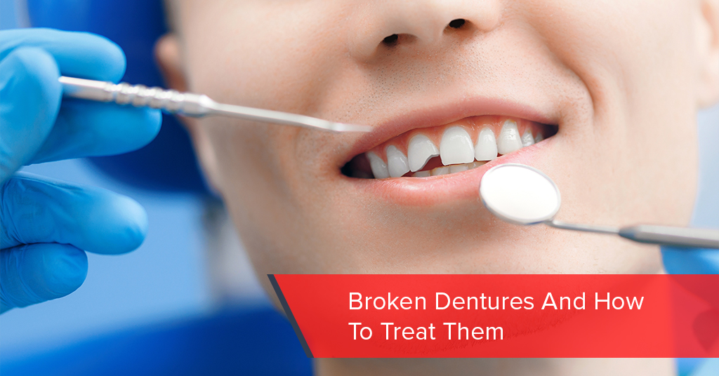 broken dentures and how to treat them