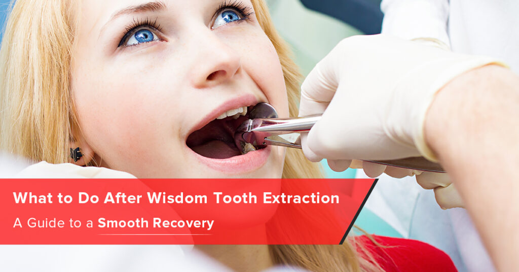 What to Do After Wisdom Tooth Extraction: A Guide to a Smooth Recovery