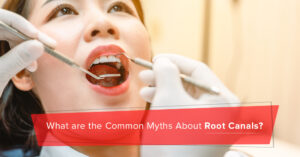 Root Canal Treatment