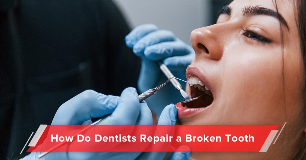 How Do Dentists Repair a Broken Tooth