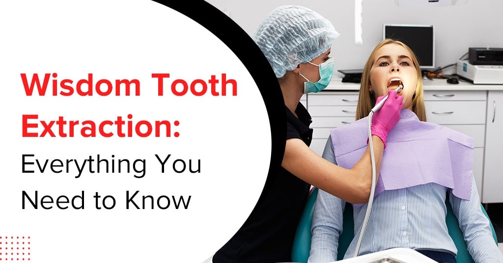 wisdom tooth extraction everything you need to know