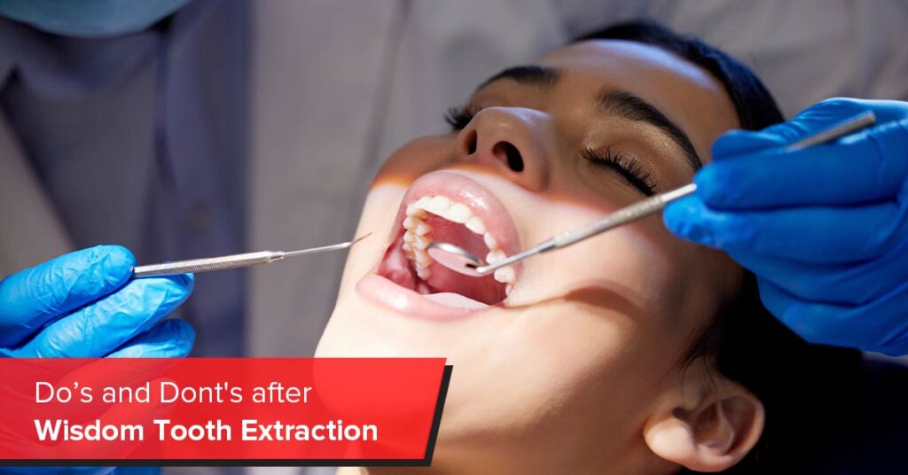 do’s and don'ts after wisdom tooth extraction