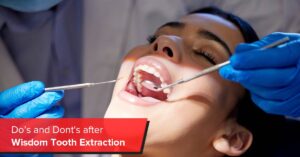 do’s and don'ts after wisdom tooth extraction