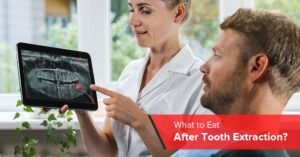 what to eat after tooth extraction