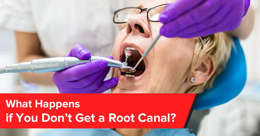 what happens if you don’t get a root canal