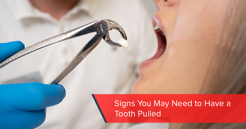 signs you may need to have a tooth pulled
